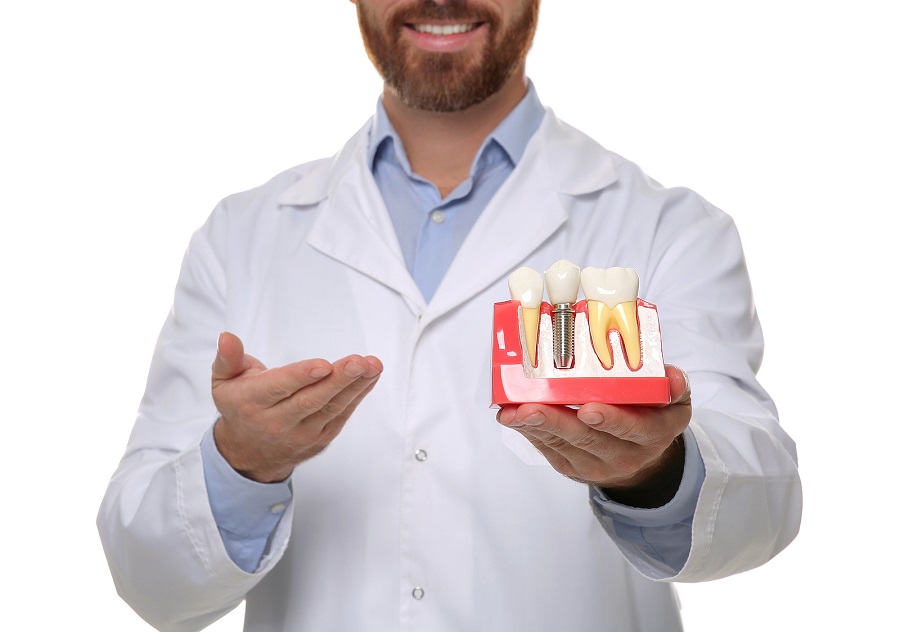 Dental Implants Are the Best Solution for Missing Teeth