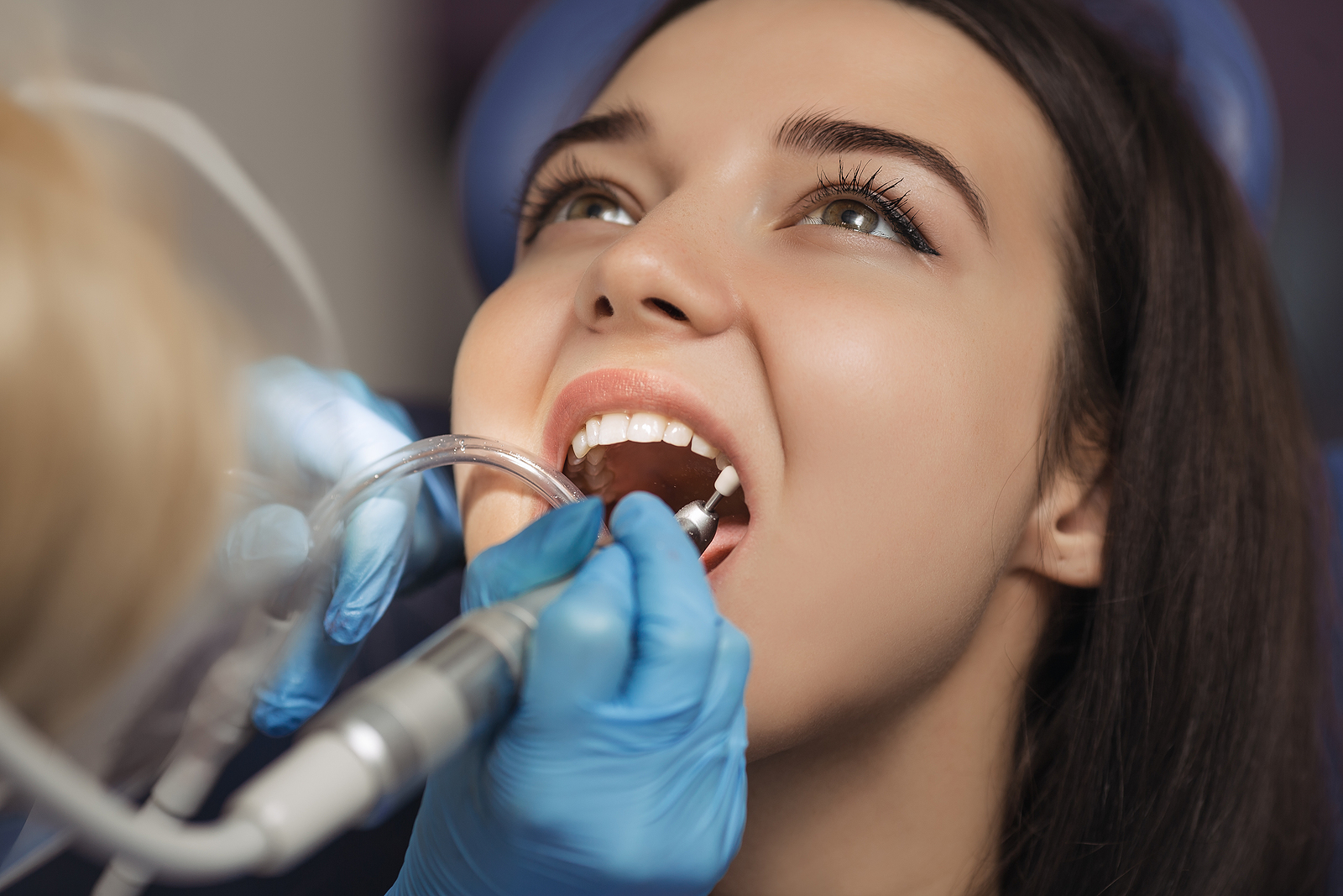 How Often Should You Visit the Dentist? Understanding the Ideal Schedule