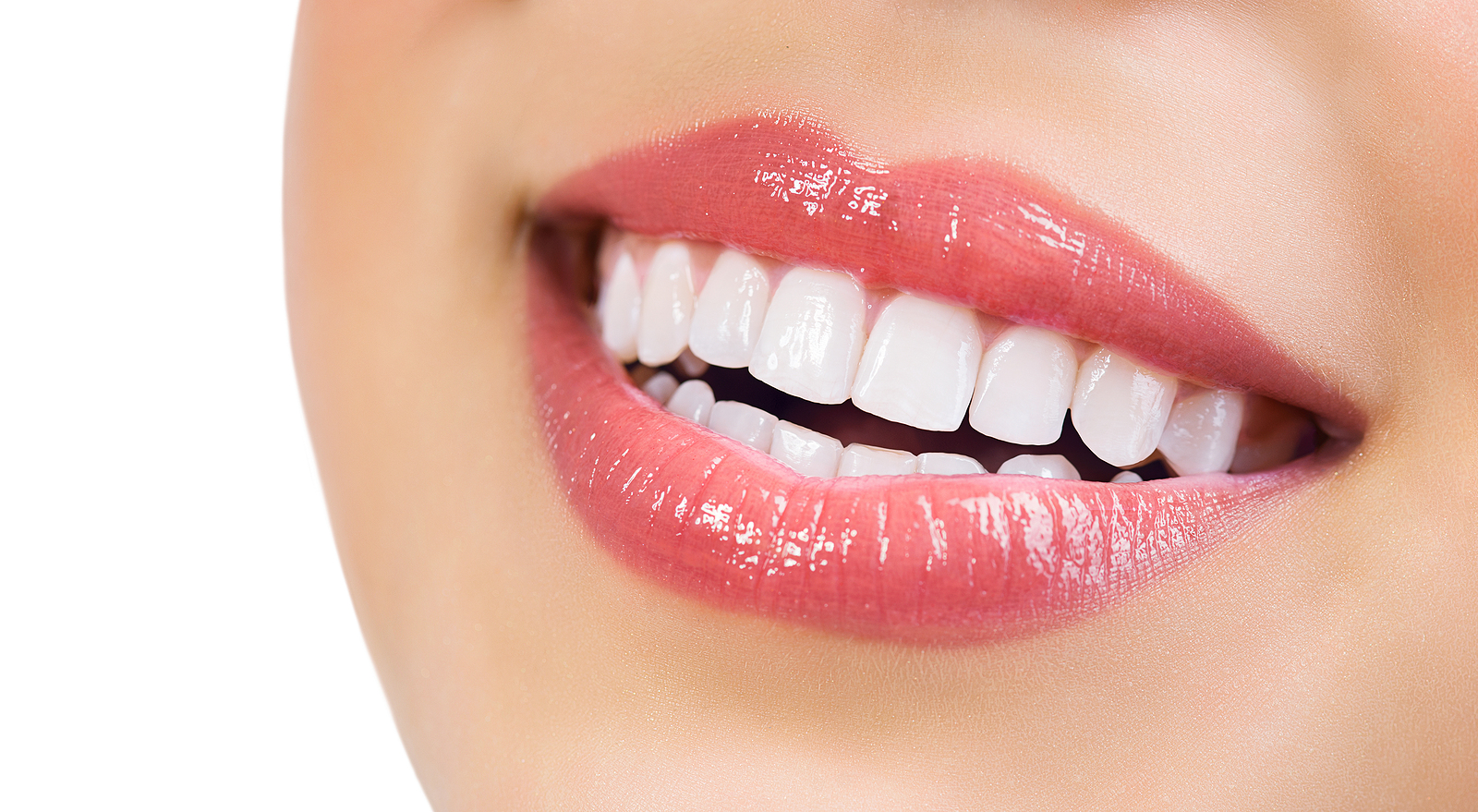 Brighter Smiles Await: Discover the Benefits of Teeth Whitening in Aiea, HI